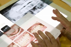 ４時間におよぶ治療説明で、両者、クタクタ！