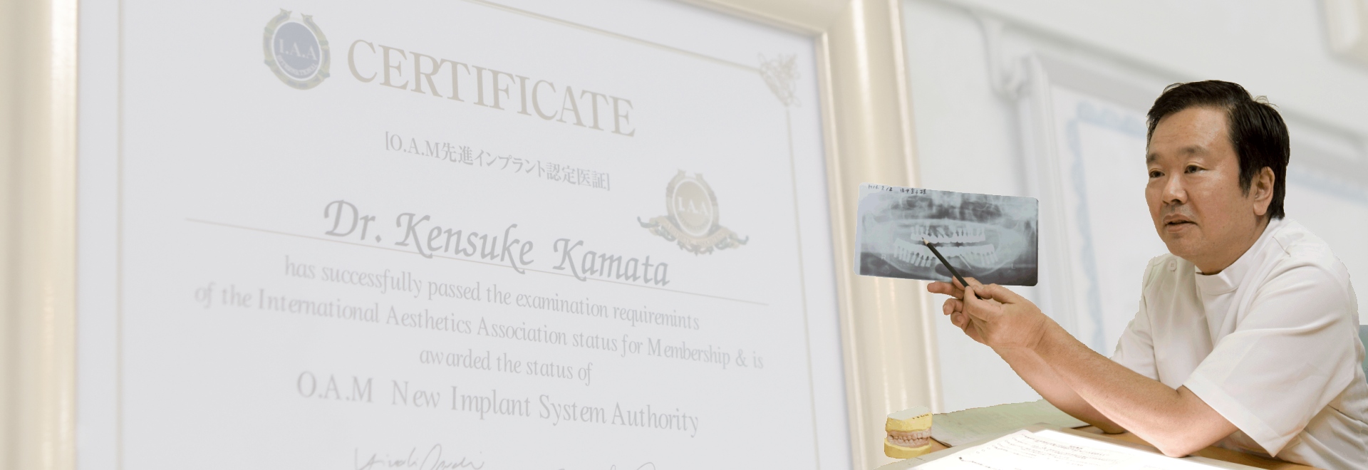 インプラント症例1000本以上