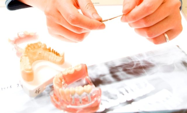 インプラント事始め